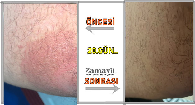 Zamavil promo